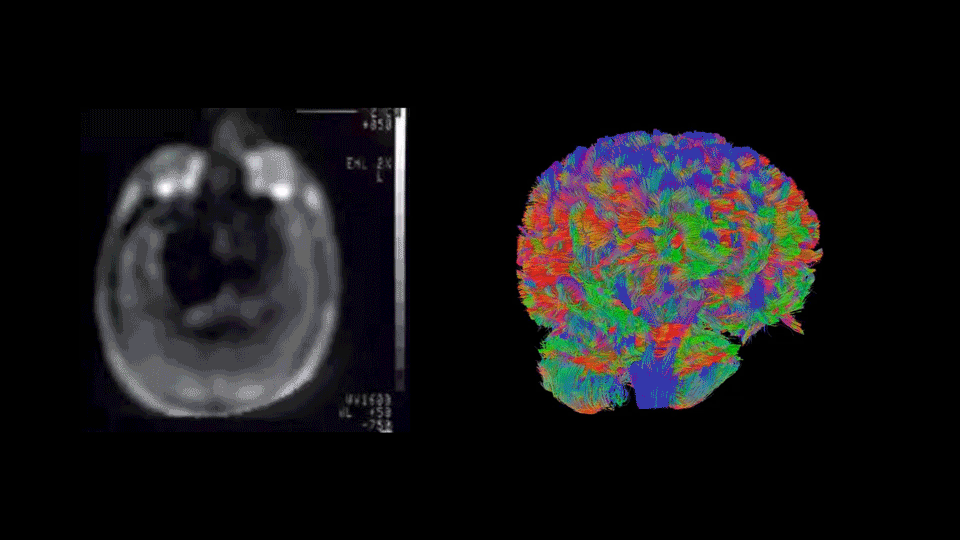 First human MR image in 1980 / Brain MR image at 5.0T in 2022