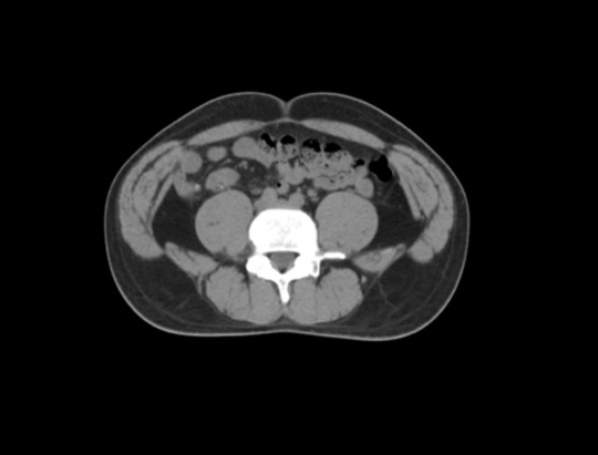 Intelligent Outlining Speed in Seconds<br/>Small Changes in Target Area Can Be Applied to Clinical Applications-pc