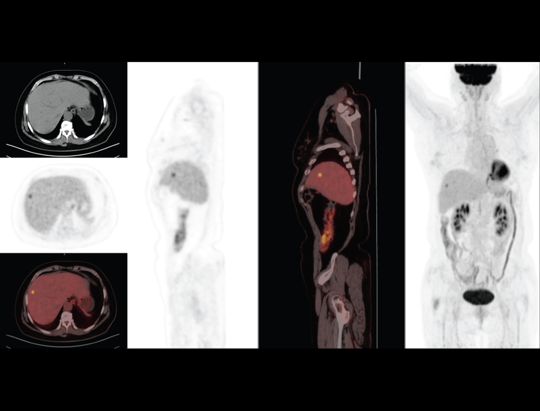 uMI 550: Digital PET/CT | United-Imaging Korea Healthcare