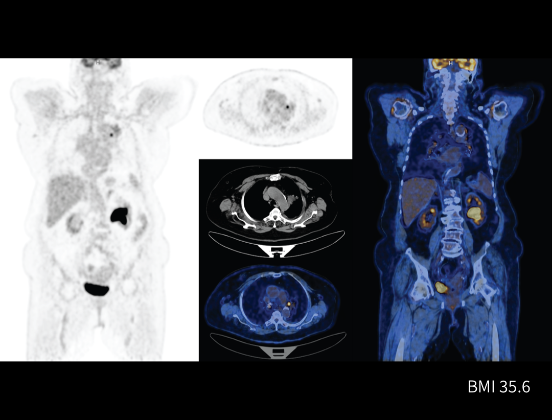 uMI 550: Digital PET/CT | United-Imaging Korea Healthcare